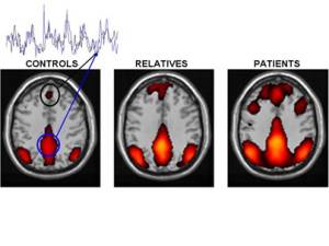 Foto: Susan Whitfield-Gabrieli, McGovern Institute for Brain Research at MIT